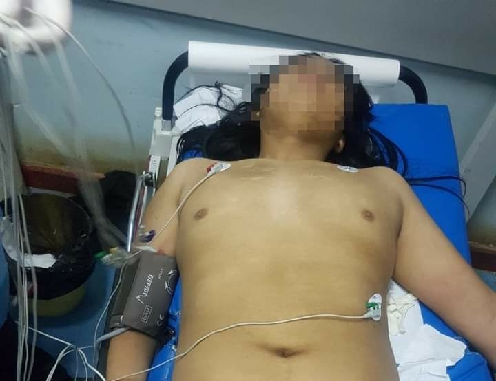 El niño de 12 años fue derivado inmediatamente al hospital de Collipulli, para luego ser trasladado de urgencia al hospital de Temuco. Foto: Radio Kvrruf.