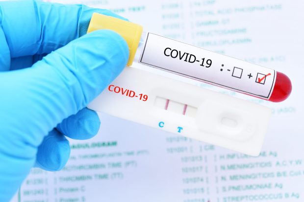Positive test result by using rapid test device for COVID-19 virus