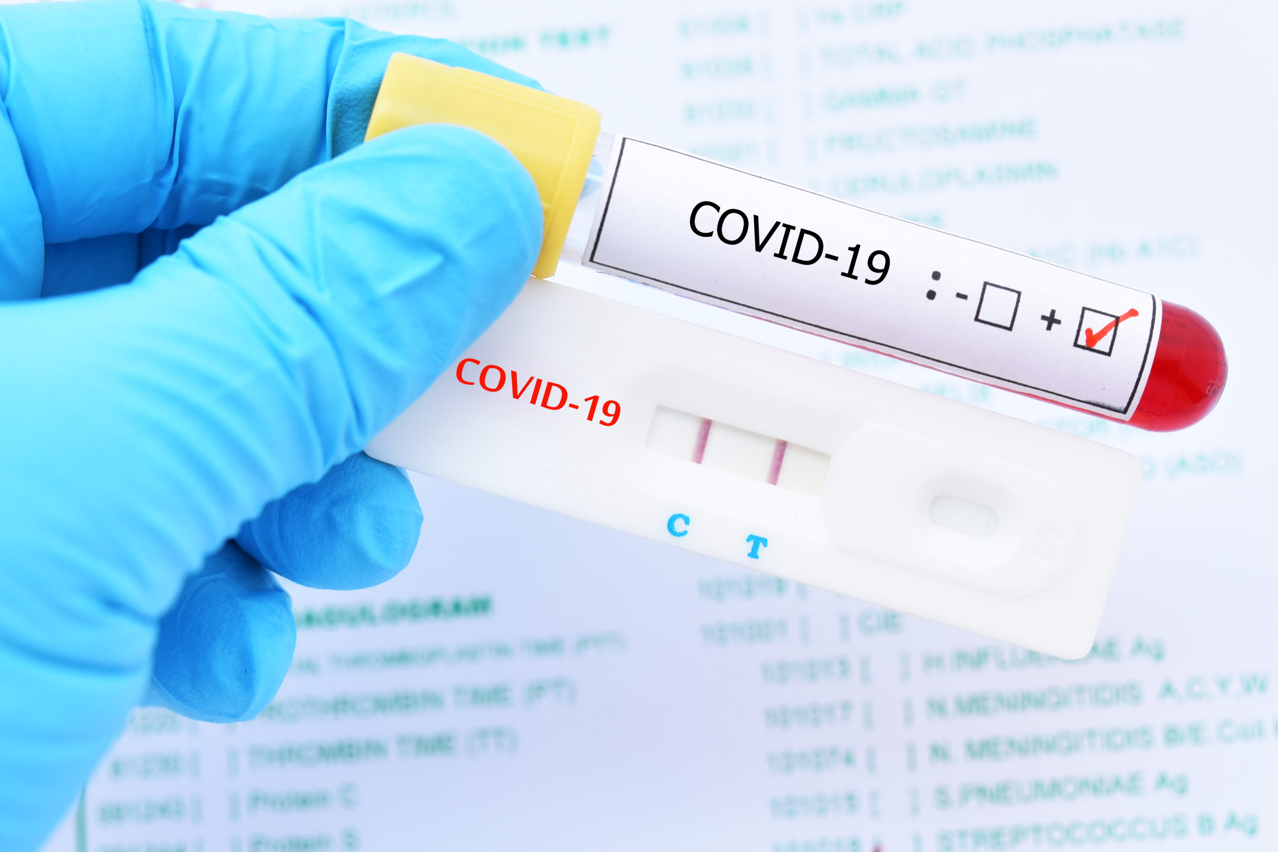 Positive test result by using rapid test device for COVID-19 virus